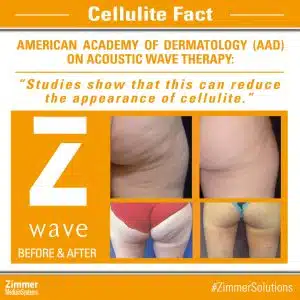 Cellulite Facts 38 AAD acoustic sound therapy for cellulite C
